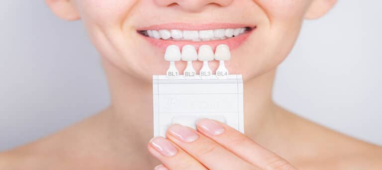 How Long Do Dental Veneers Last