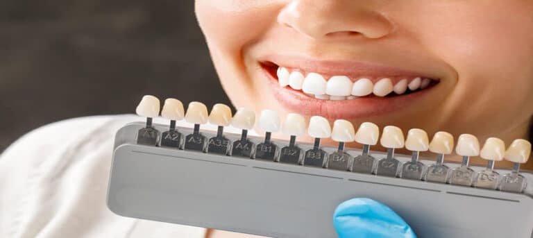 How Do Dental Veneers Work