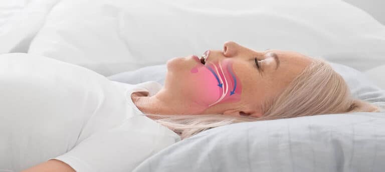Cure Sleep Apnea Naturally at Home