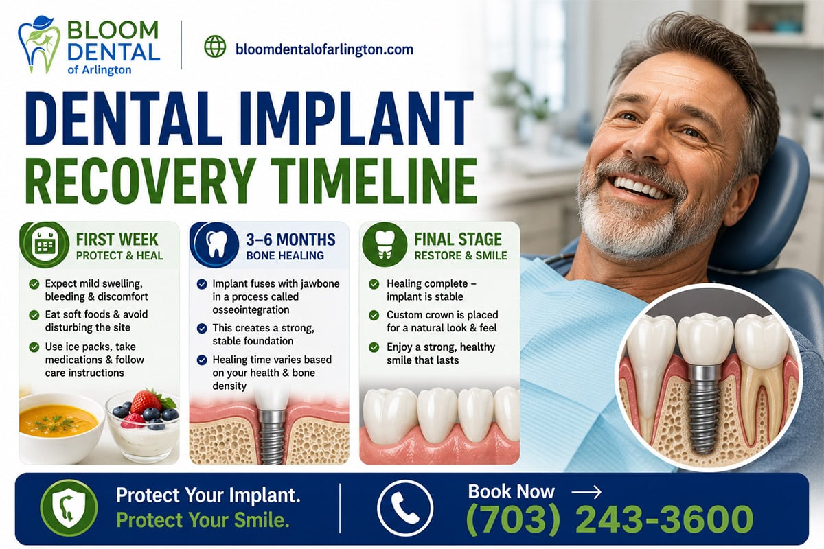 dental implant recovery