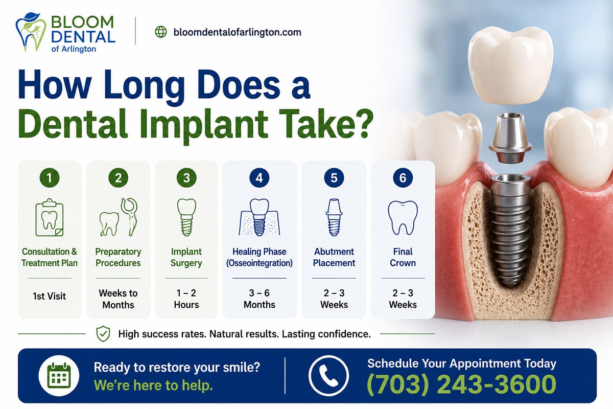 How Long Does a Dental Implant Procedure Take