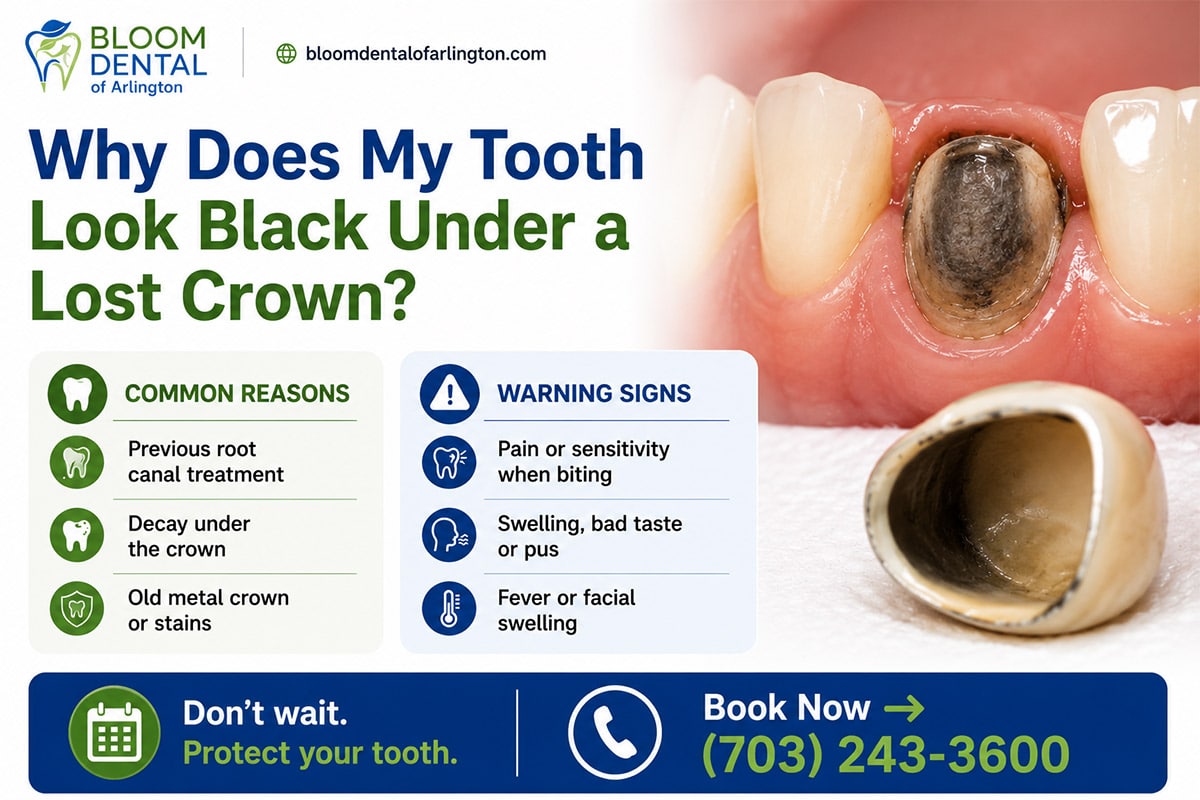 Tooth Looks Black Under a Lost Crown