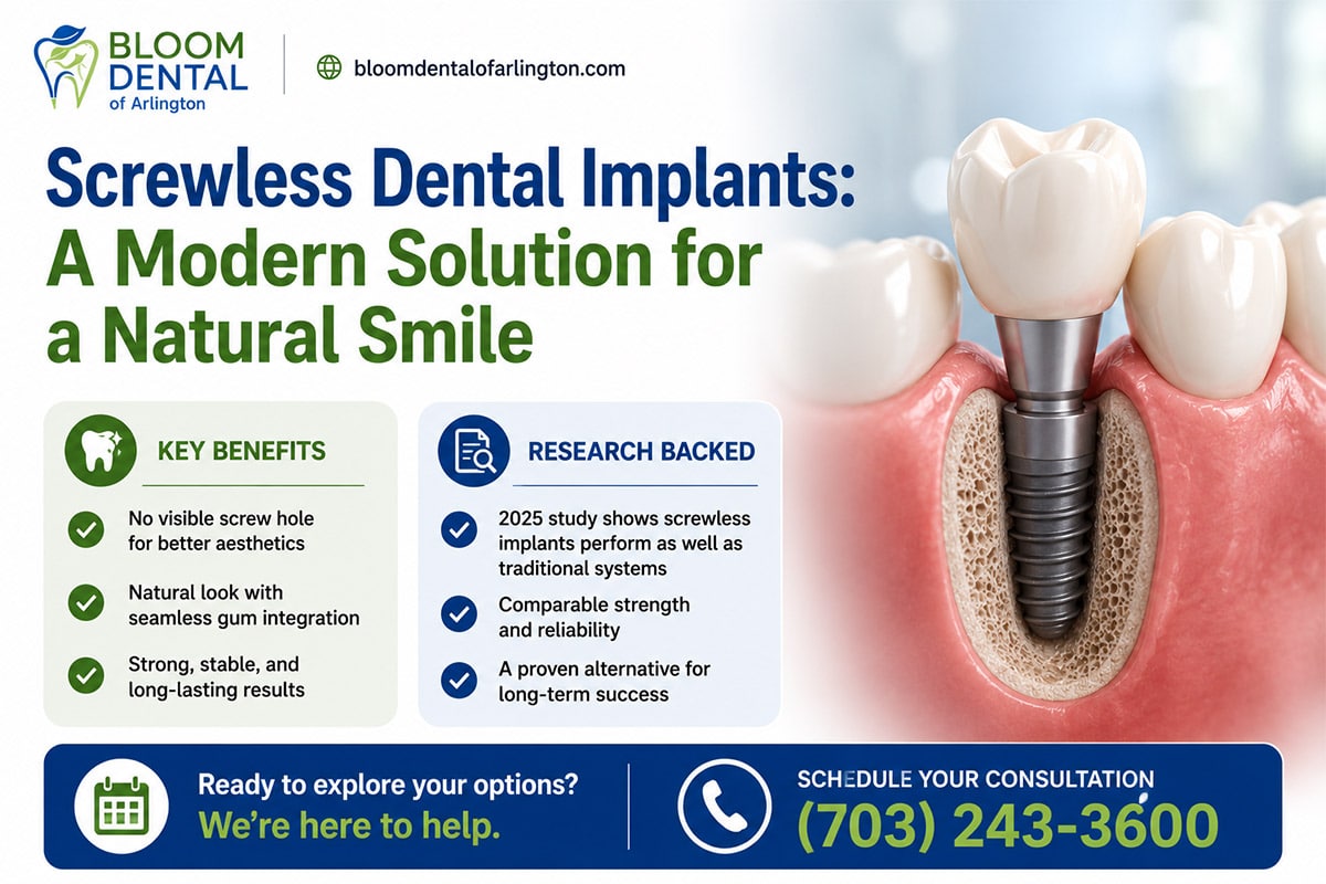 screwless dental implants