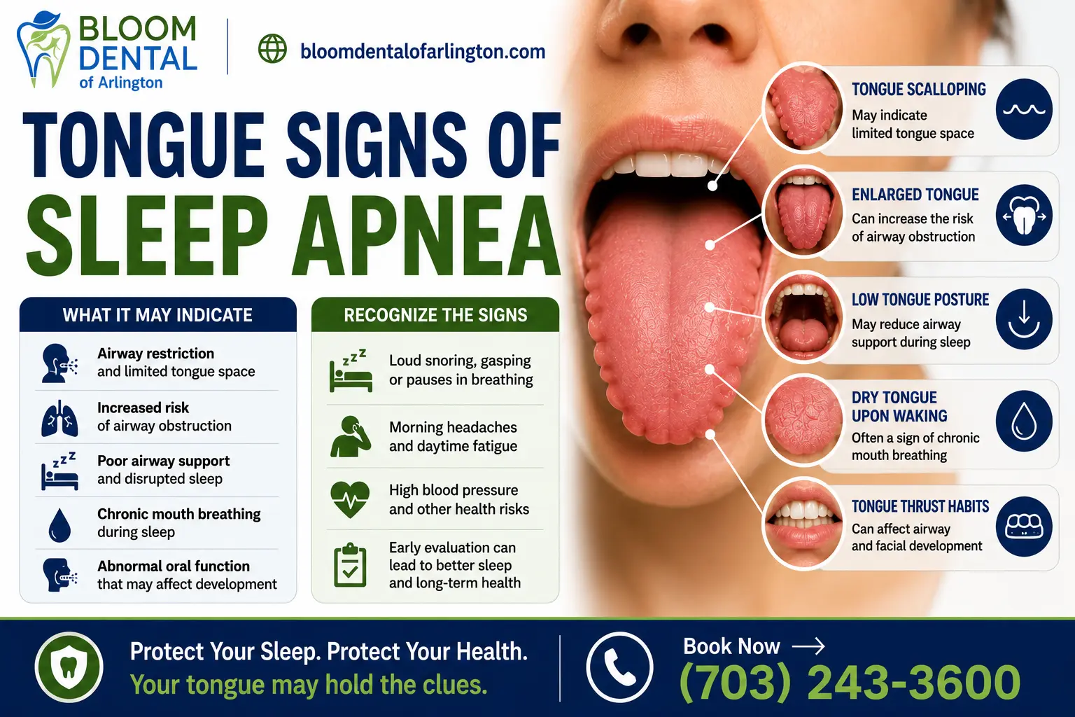 tongue signs of sleep apnea