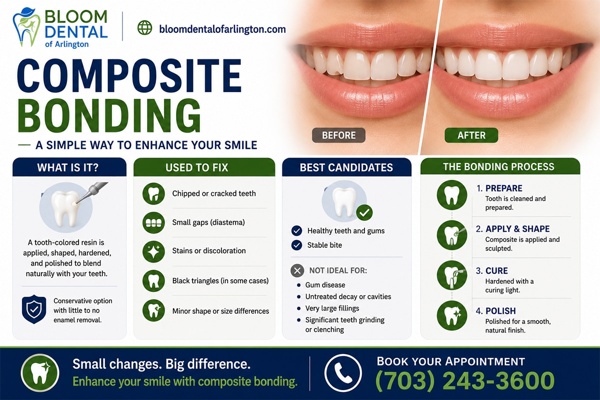 what is Composite Bonding