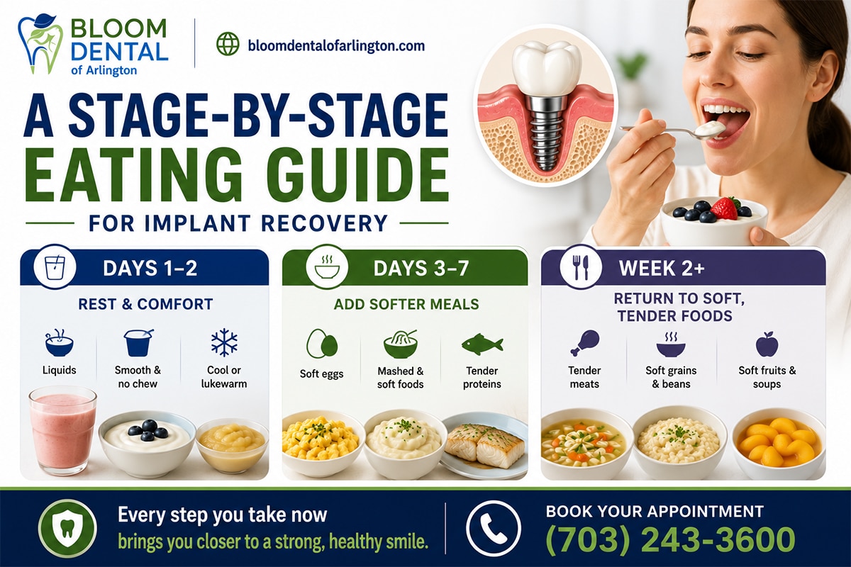 soft foods to eat after dental implant surgery