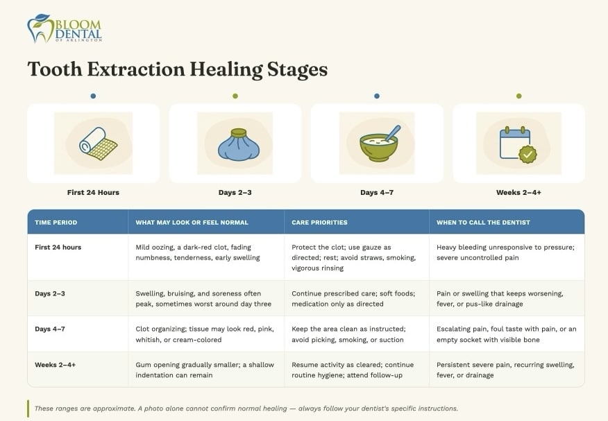 Extraction Healing Timeline